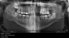 OPT dhr Knipmeyer.jpg